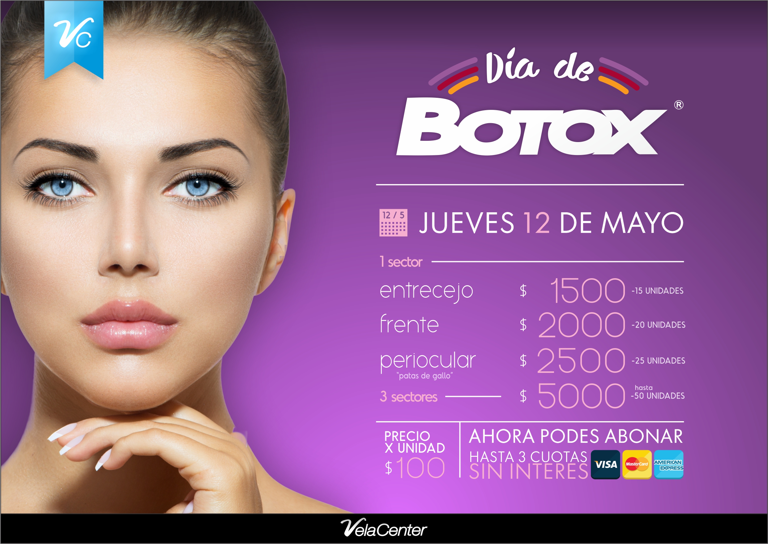 botox 2016 1