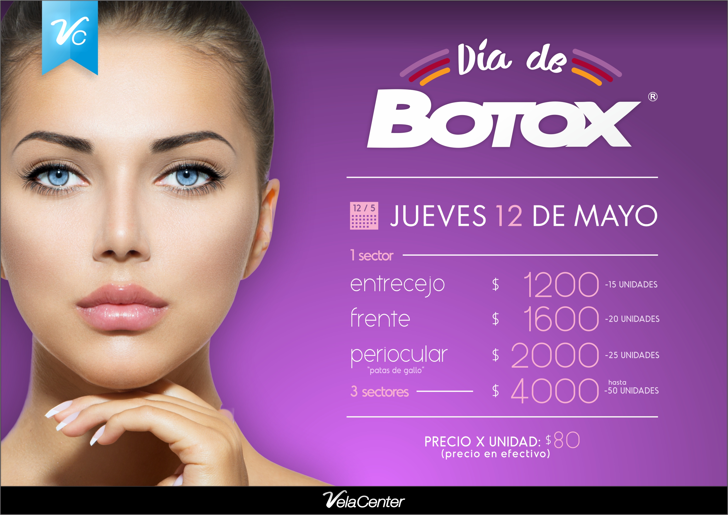 botox 2016 2