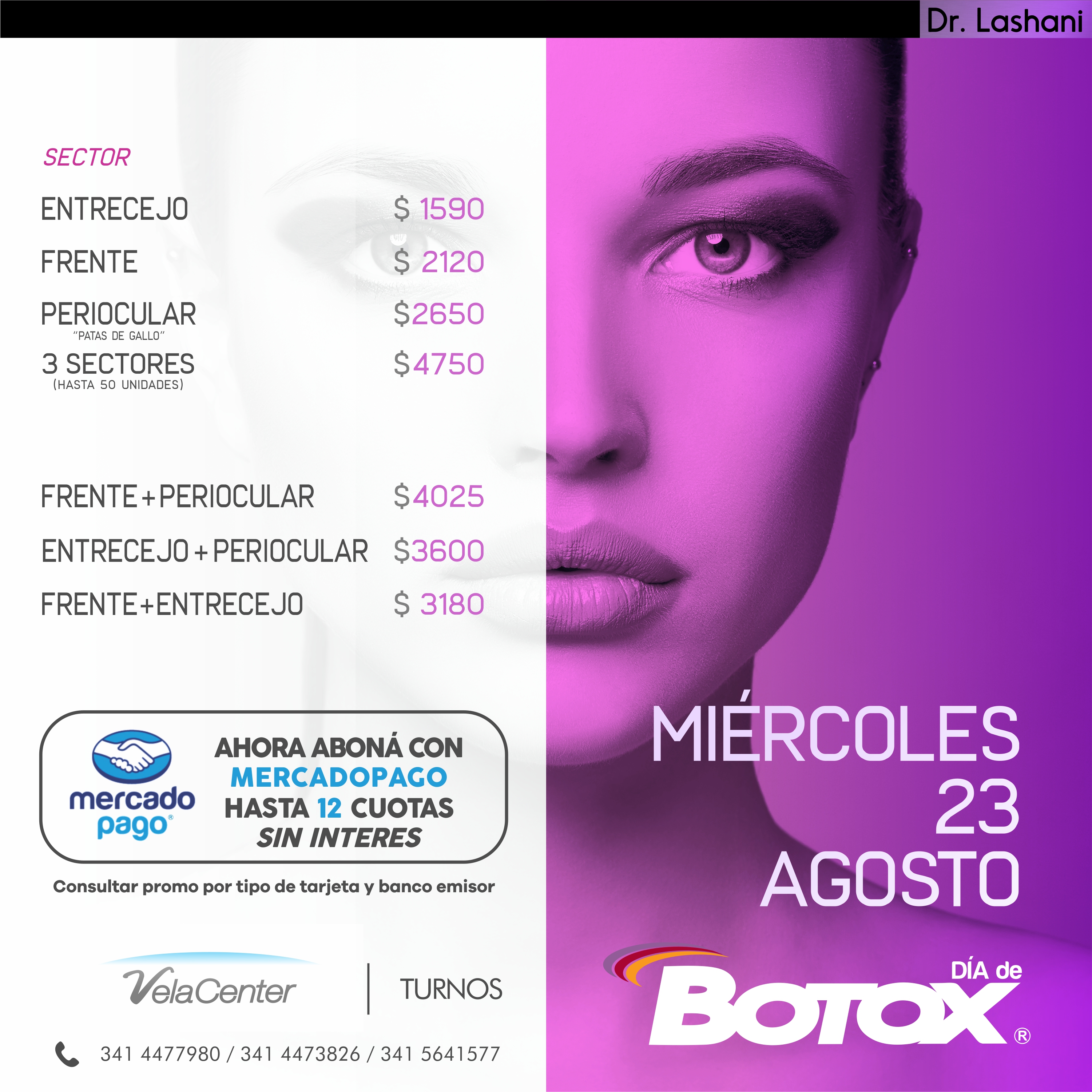 botox 2017 b